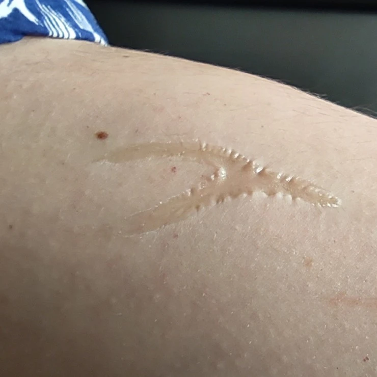 Collodion Kryolan 11ml 2 Collodion Kryolan 11ml – Image 2