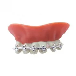 Dentier Avec Appareil Dentaire